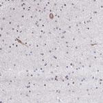 SAPCD2 Antibody in Immunohistochemistry (Paraffin) (IHC (P))