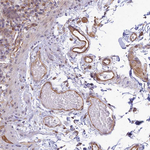 SAPCD2 Antibody in Immunohistochemistry (Paraffin) (IHC (P))