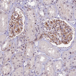 SAPCD2 Antibody in Immunohistochemistry (Paraffin) (IHC (P))