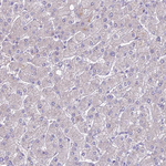 SAPCD2 Antibody in Immunohistochemistry (Paraffin) (IHC (P))