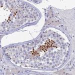 PRR22 Antibody in Immunohistochemistry (Paraffin) (IHC (P))