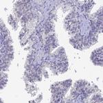 PRR22 Antibody in Immunohistochemistry (IHC)