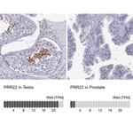 PRR22 Antibody