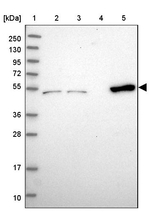 CCDC149 Antibody in Western Blot (WB)