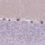 ZNF501 Antibody in Immunohistochemistry (Paraffin) (IHC (P))