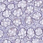 TMEM40 Antibody in Immunohistochemistry (IHC)