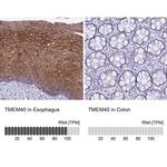 TMEM40 Antibody