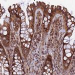 COMMD2 Antibody in Immunohistochemistry (Paraffin) (IHC (P))