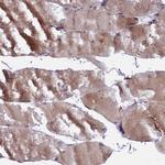 COMMD2 Antibody in Immunohistochemistry (Paraffin) (IHC (P))