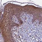 COMMD2 Antibody in Immunohistochemistry (Paraffin) (IHC (P))