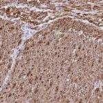 SYNM Antibody in Immunohistochemistry (IHC)