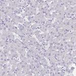 SYNM Antibody in Immunohistochemistry (IHC)