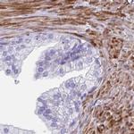 SYNM Antibody in Immunohistochemistry (IHC)