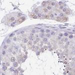 SYNM Antibody in Immunohistochemistry (IHC)