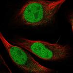 HDGFRP2 Polyclonal Antibody