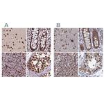 HDGFRP2 Antibody in Immunohistochemistry (IHC)