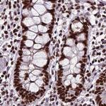 HDGFRP2 Antibody in Immunohistochemistry (IHC)