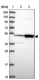 MKKS Antibody in Western Blot (WB)