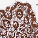 MKKS Antibody in Immunohistochemistry (IHC)