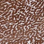 PPM1H Antibody in Immunohistochemistry (Paraffin) (IHC (P))