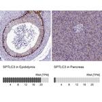 SPTLC3 Polyclonal Antibody