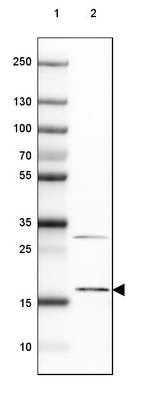 SNRNP25 Antibody in Western Blot (WB)