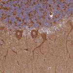 SNRNP25 Polyclonal Antibody