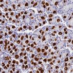 LYRM5 Antibody in Immunohistochemistry (Paraffin) (IHC (P))