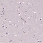 ELSPBP1 Antibody in Immunohistochemistry (Paraffin) (IHC (P))