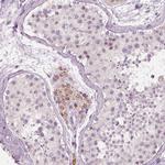 ELSPBP1 Antibody in Immunohistochemistry (Paraffin) (IHC (P))