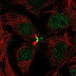 LBX2 Polyclonal Antibody