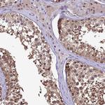 ZNF643 Antibody in Immunohistochemistry (Paraffin) (IHC (P))