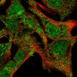 SDR39U1 Polyclonal Antibody