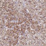 SDR39U1 Antibody in Immunohistochemistry (Paraffin) (IHC (P))