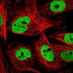 COPS6 Polyclonal Antibody