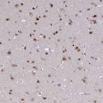 COPS6 Antibody in Immunohistochemistry (Paraffin) (IHC (P))