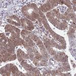 COPS6 Antibody in Immunohistochemistry (Paraffin) (IHC (P))