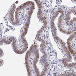 COPS6 Antibody in Immunohistochemistry (Paraffin) (IHC (P))