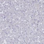 COPS6 Antibody in Immunohistochemistry (Paraffin) (IHC (P))