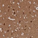 ADAMTS18 Polyclonal Antibody