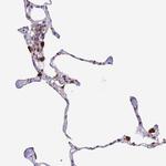 TMEM104 Antibody in Immunohistochemistry (Paraffin) (IHC (P))