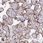 TMEM104 Antibody in Immunohistochemistry (Paraffin) (IHC (P))