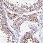 TMEM104 Antibody in Immunohistochemistry (Paraffin) (IHC (P))