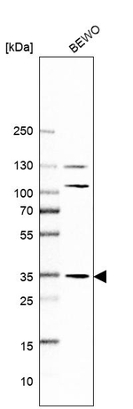AMPK beta-2 Antibody in Western Blot (WB)