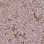 ARRDC1 Polyclonal Antibody