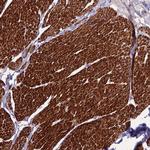 CLUH Antibody in Immunohistochemistry (Paraffin) (IHC (P))