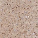 CACNA1B Polyclonal Antibody