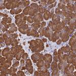 GID4 Antibody in Immunohistochemistry (Paraffin) (IHC (P))