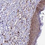 GID4 Antibody in Immunohistochemistry (Paraffin) (IHC (P))
