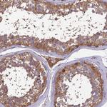 GID4 Antibody in Immunohistochemistry (IHC)